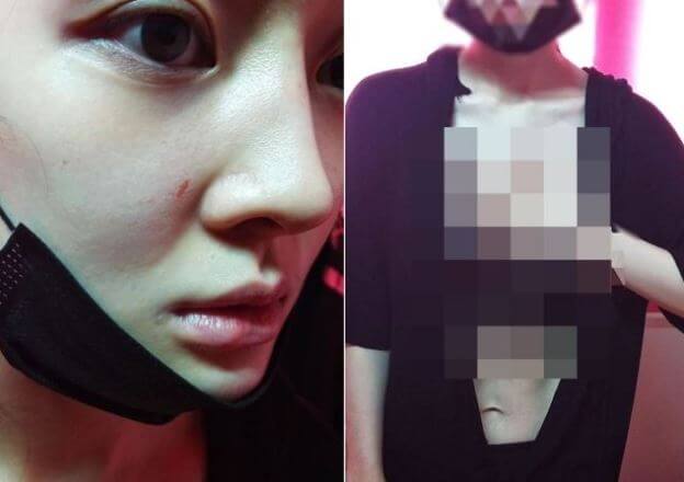 티아라 아름, 극단적 선택..의식이 없다 - 아름이 SNS에 게재한 가정폭력사진